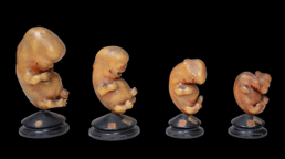 Ziegler studio wax models showing the stages of development of the human embryo, on display in the Two Centuries Here exhibition